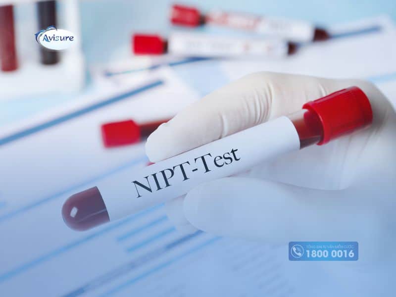 Xét nghiệm NIPT - Phương pháp xác định giới tính thai nhi